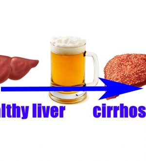 How Much Alcohol Would You Have to Drink Before Liver Damage?