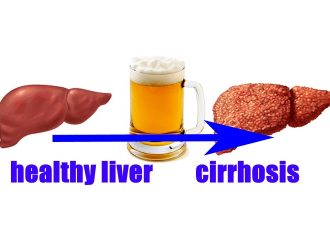 How Much Alcohol Would You Have to Drink Before Liver Damage?