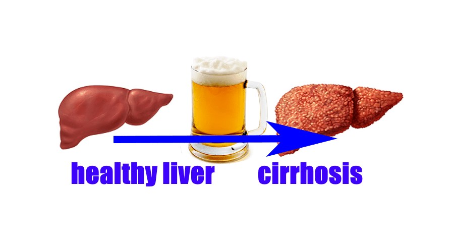 Liver Damage