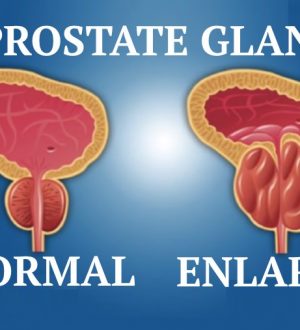 The number 1 Important Nutrient to Shrink Your Prostate