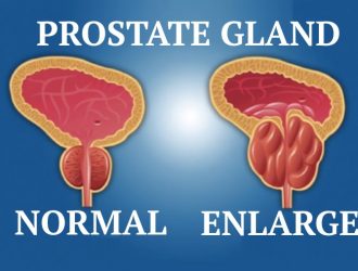 The number 1 Important Nutrient to Shrink Your Prostate