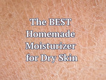 The BEST Homemade Moisturizer for Dry Skin